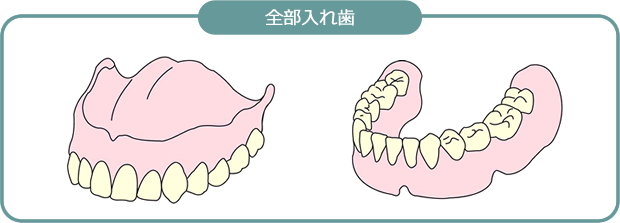 全部入れ歯